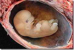 800px-Human_Embryo_-_Approximately_8_weeks_estimated_gestational_age