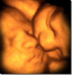 twin kiss Source:  prenatalvision.blogspot.com/2010/07/4d-ultrasound-captures-twins.html