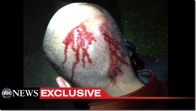 george_zimmerman_head_right-after-shooting