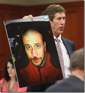 usa-george-zimmerman-trial-bloodied-face